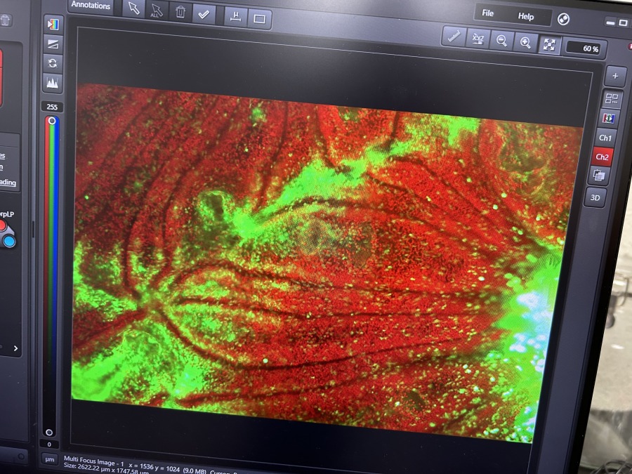 写真の答え合わせとGFPの研究について